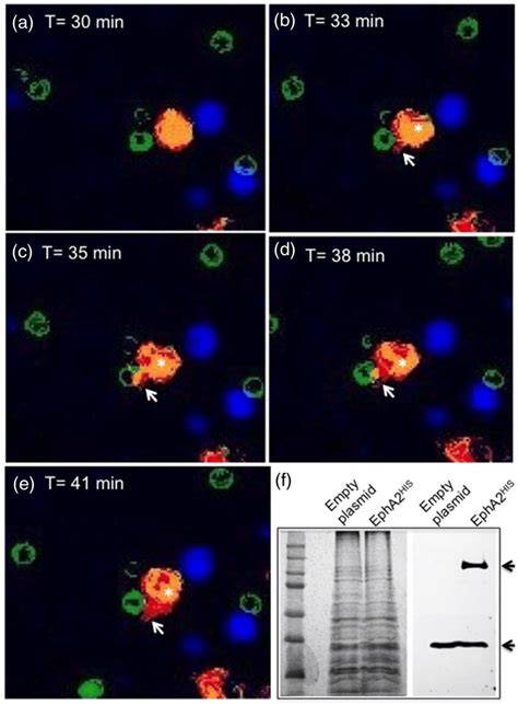 Hek293t Cells Overexpressing Eph Ephrina1 Epha2 Display A Direct