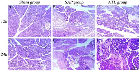 Representative Photographs Of HE Stained Pancreas Pathological Section