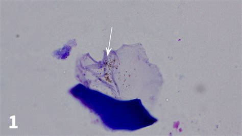 Image Gallery: Normal vs Abnormal Ear Cytology | Clinician's Brief