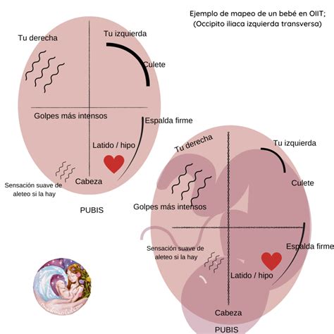 Posici N Posterior Y Pr Dromos Insidiosos Comadrona En La Ola