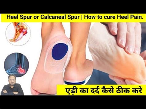 How To Cure Heel Pain Heelpain