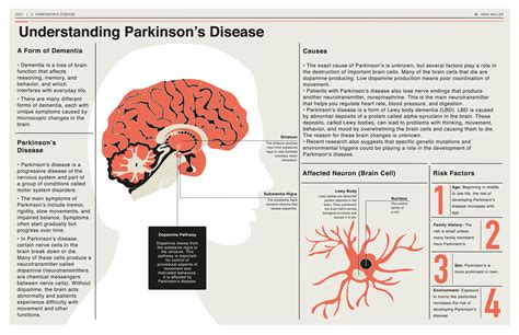 lewy body dementia parkinsons dementia penn memory center