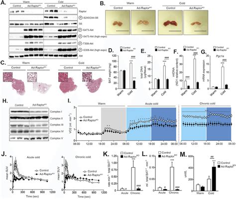 Loss Of MTORC1 Impairs Cold Induced BAT Expansion Mitochondrial