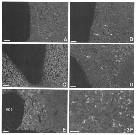 A C Fluorescence Photomicrographs Showing Fl Adr Ir Containing Fibers Download Scientific