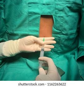 Spinal Anaesthesia Procedure Done Under Sterile Stock Photo 1162263622 ...