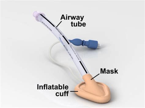 Laryngeal Mask Airway Insertion Procedures Consult Japan