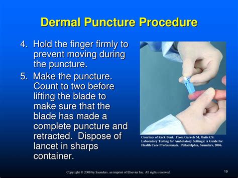 Dermal Puncture Order Of Draw