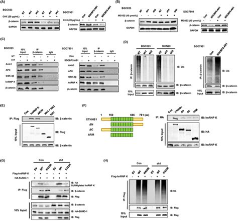 SDCBP2AS1 destabilized βcatenin by blocking SUMOylation of hnRNP K