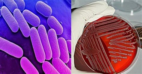 Klebsiella Structure