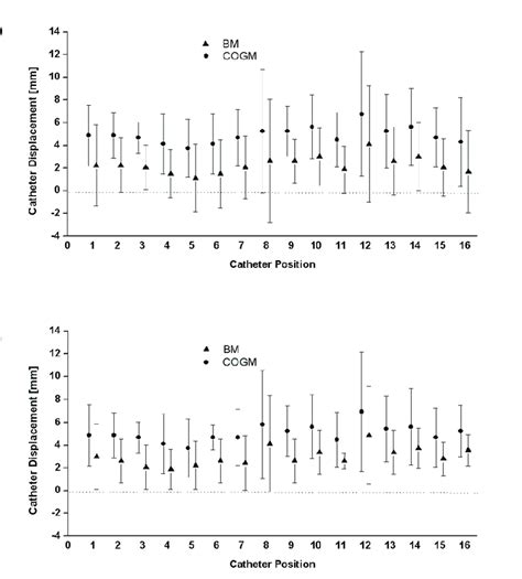 A Measurement Of Craniocaudal Catheter Displacement Using The Bony