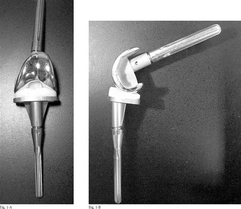 Figure From Revision Total Knee Arthroplasty With Use Of A