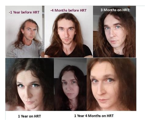 33 Yo And 16 Months On Hrt R Transtimelines