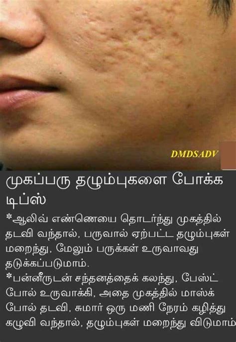 Pin By Arunachalam On Beauty Health And Beauty Tips Simple Health