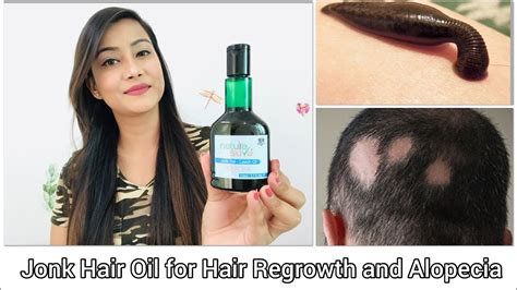 Leech Oil For Hair Regrowth Alopecia And Baldness Nature Sure Jonk Oil