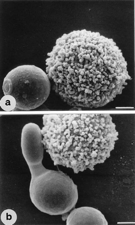 Interactions Between Lak Cells And Germ Tubes Of C Albicans A A Download Scientific