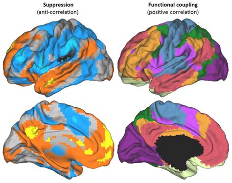 Different Criteria For Defining Brain Networks Functional Networks