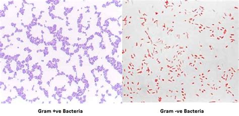 Gram staining - Public Health Notes