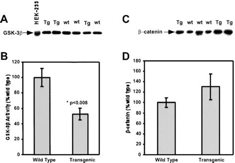 Transgenic PKC βII mice exhibit decreased GSK 3β activity and increased