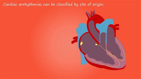 Difference Between Afib And Atrial Flutter Artofit