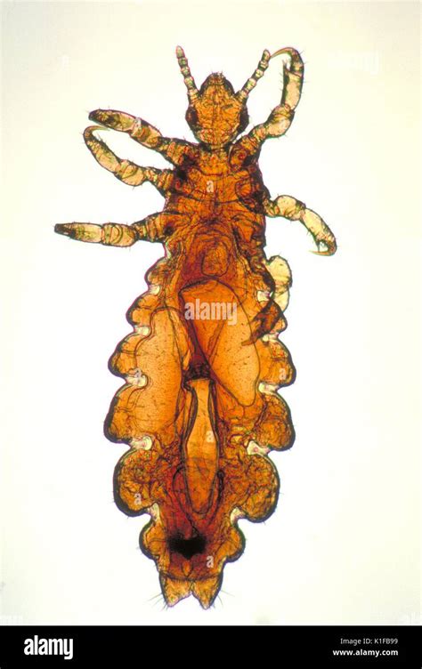 Esta Imagen Muestra Una Vista Dorsal De Un Piojo De La Cabeza Hembra