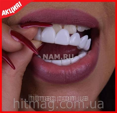 Инновационные виниры Perfect Smile Veneers (съемные), цена 399 грн ...