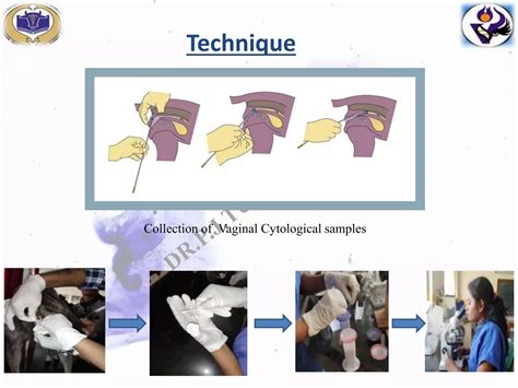 Vaginal Exfoliative Cytology PPT