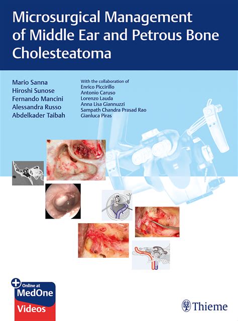 Microsurgical Management Of Middle Ear And Petrous Bone Cholesteatoma