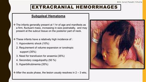 Neonatal Intracranial Hemorrhage By Dr Sonali Mhatre Ppt