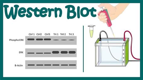 【实验技术学习笔记】western Blot 知乎