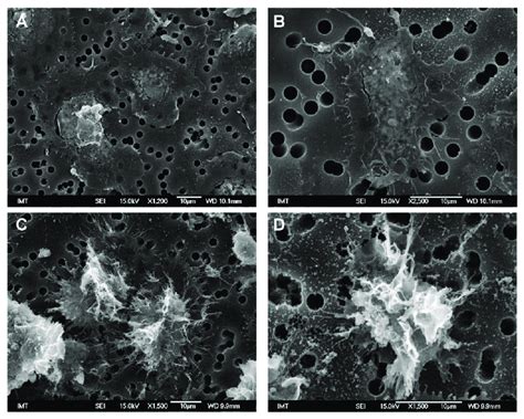 Scanning electron microscopy (SEM) images of control hemocytes from M.... | Download Scientific ...