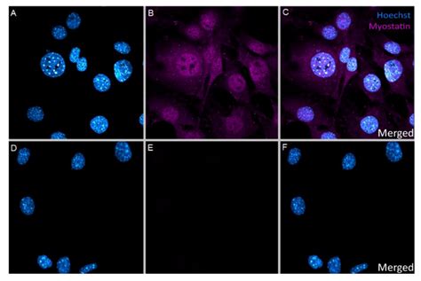 Ijms Free Full Text Myostatin Inhibits Vascular Smooth Muscle Cell