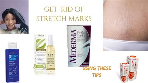 Get Rid Of Stretch Marks Using These Tips Best Stretch Marks Creams