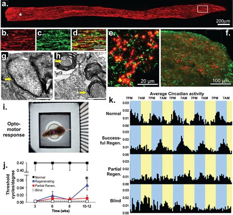 Optic Nerve Regeneration A Long View IOS Press