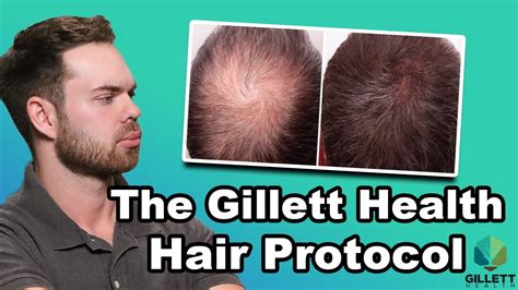 The Gillett Health Hair Protocol The Gillett Health Podcast Youtube