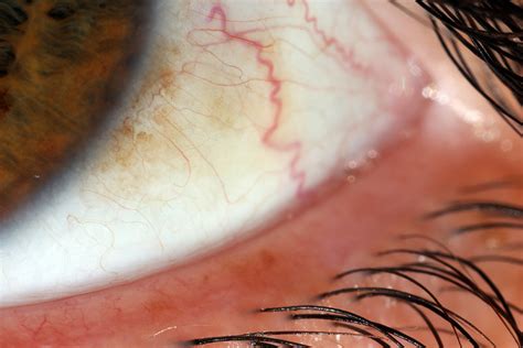 Sclera Macroscopic Solutions Inspiring Discovery