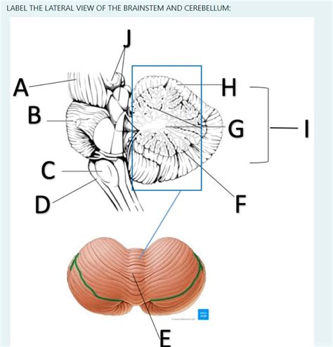 solved label  lateral view   brainstem  cheggcom