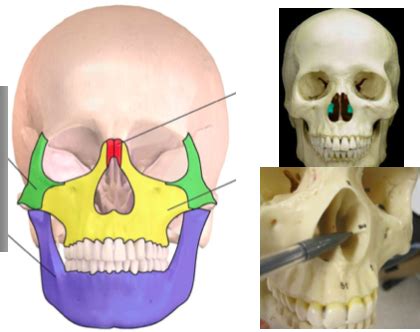 Sectional Anatomy - MODULE 3 - Face - NASAL BONES & INFERIOR NASAL ...