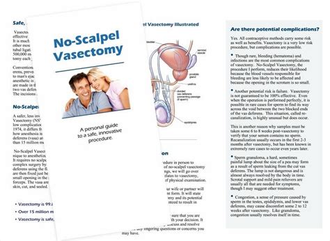 Patient Brochures No Scalpel Vasectomy Counseling