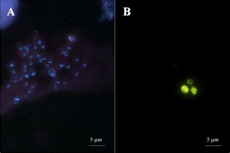 Examples Of Positive Microscopic Observation Showing Pneumocystis Download Scientific Diagram