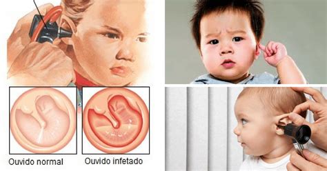 Como Saber Se O Bebê Está Com Dor De Ouvido - Dor De Ouvido Em Bebe: Causas, Sintomas E Tratamentos