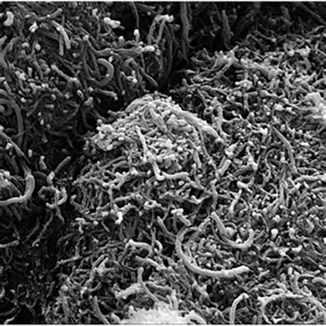 Field Emission Scanning Electron Microscopy Fe‐sem Image With Its