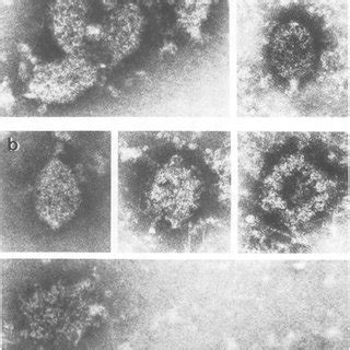 Electron Micrographs Of Negatively Stained Isolated Naked Prohead