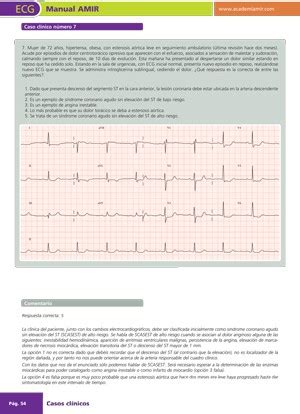 Manual Electrocardiografía ECG AMIR