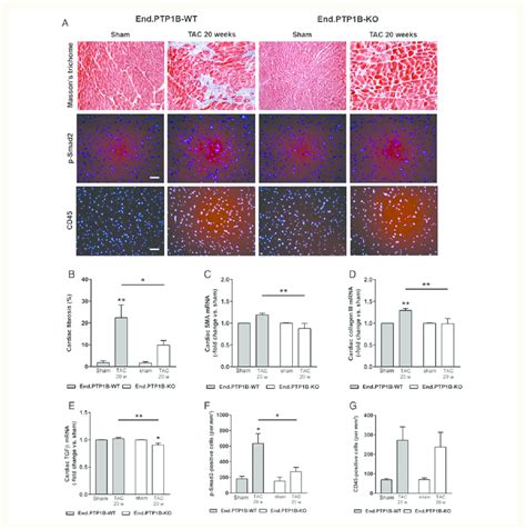 Effect Of Endothelial Ptp B Deletion On Cardiac Fibrosis And Tgfb