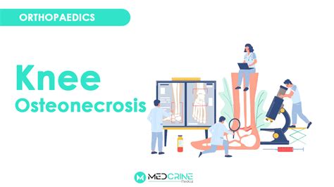 Knee Osteonecresis Avascular Necrosis Medcrine