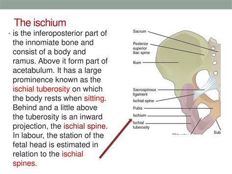 Anatomy Of The Female Pelvis Ppt Download