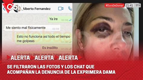 Denuncia Contra Alberto Fern Ndez Las Fotos De Fabiola Ya Ez Golpeada