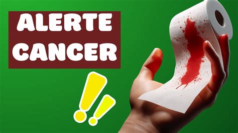 Comment D Tecter Et Pr Venir Le Cancer Colorectal Signes Et M Thodes