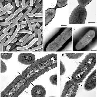 Ultrastructural Carboxysome Diversity In Cells Of Synechococcus Sp PCC