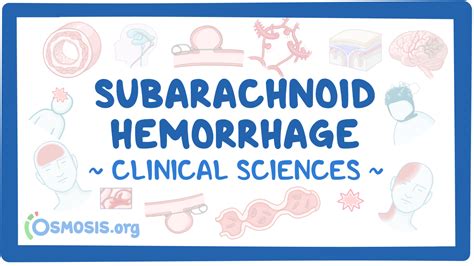 Subarachnoid Hemorrhage Video Meaning Osmosis